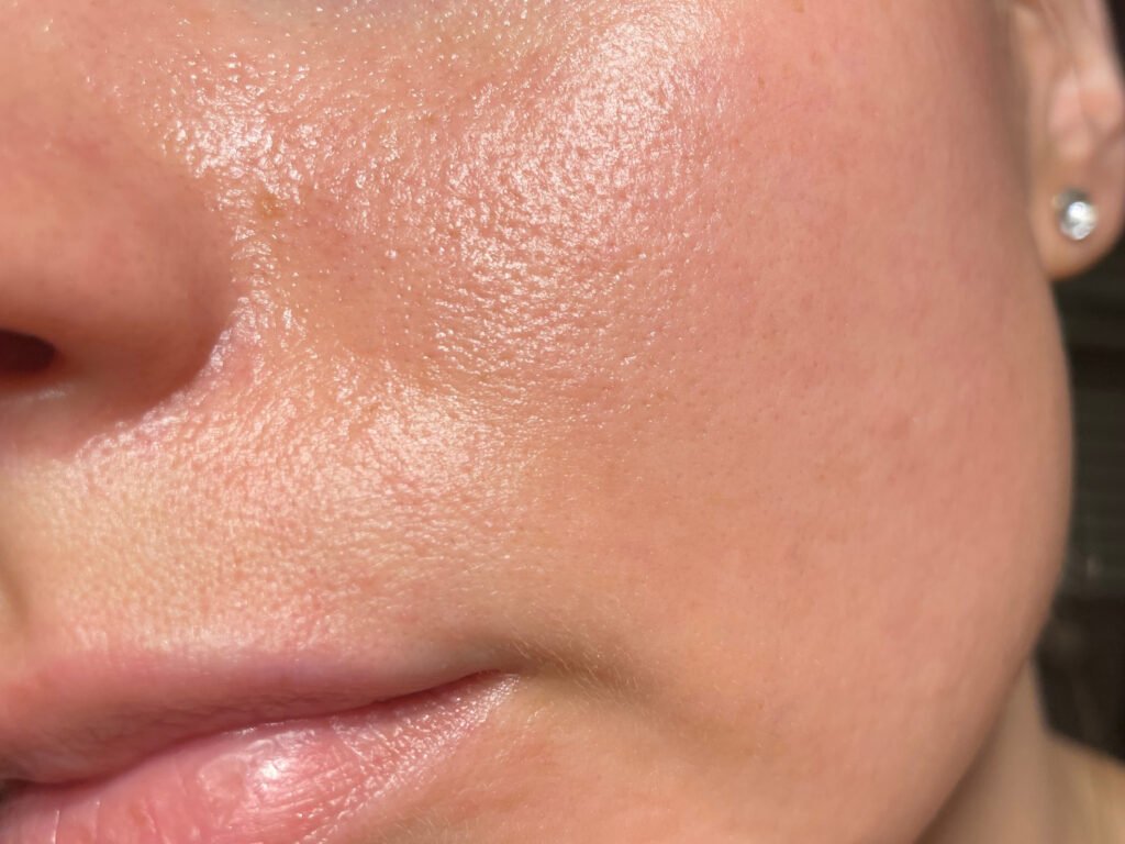 Sensitive Skin